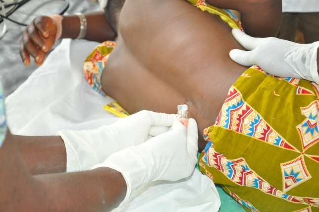 patient-Lumbar-Puncture