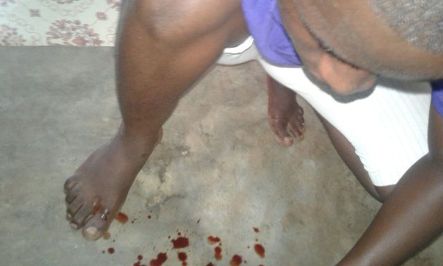 Hon Ahuahey after the slap